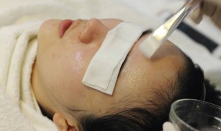 如何改善面部红血丝（如何改善面部红血丝?）
