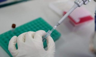 核酸检测前后注意什么（核酸检测前注意啥）