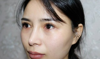 眼袋怎么去掉（女人眼袋怎么去掉）