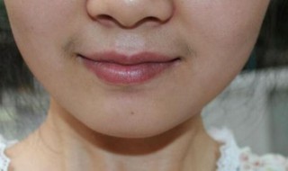 女生如何淡化唇毛 女生如何淡化唇毛最有效