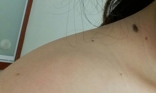 锁骨上有痣代表什么（女生左锁骨上有痣代表什么）