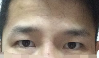 怎样去眼角纹（怎样去眼角纹最有效方法）