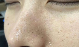 去黑头的小窍门 去黑头的小窍门是什么