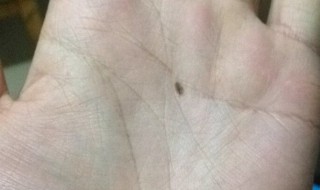 掌心有痣代表什么 右手掌心有痣代表什么