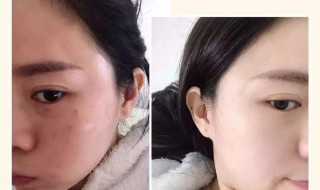 天生的黑皮肤如何变白（天生的黑皮肤如何变白的简单方法）