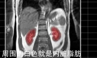 怎么知道是不是内脏脂肪多（怎么看是不是内脏脂肪）