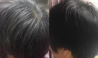 天然染黑发的方法（天然染黑发的方法图片）