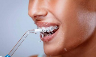冲牙器正确使用方法 冲牙器正确使用方法