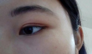 怎样贴双眼皮贴（怎样贴双眼皮贴自然）