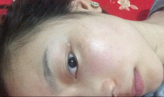 斑怎样才能清除 斑怎么才能去除