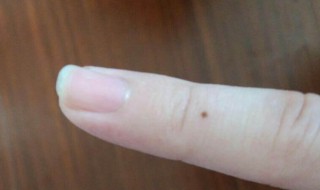 苍蝇屎在脸上怎么去掉（苍蝇屎在脸上怎么去掉视频）